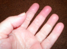 fingers