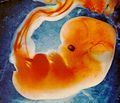 Fetal human
