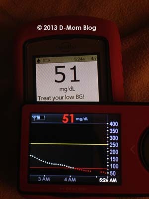 Matching BG CGM