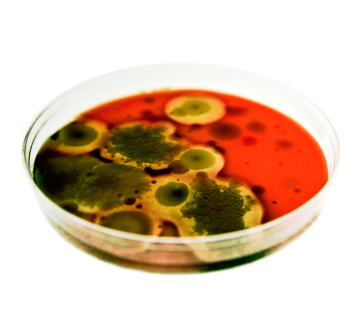 bacteria petri dish