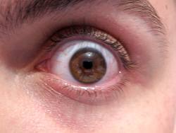 Eye