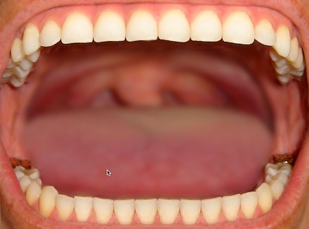 mouth