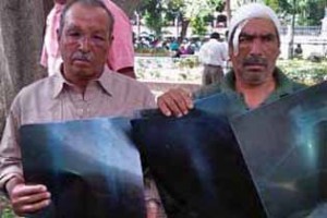 Two Mexican men show evidence of torture over their evangelical faith (Oscar Rodriguez/Milenio) 