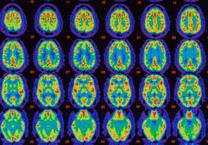 How To Change Your Brain For The Better