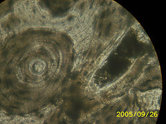 osseous (bone) tissue
