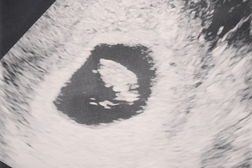 8-week ultrasound