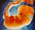 Fetal-human-300x256