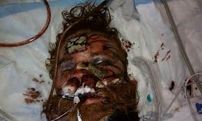 kelly thomas beaten