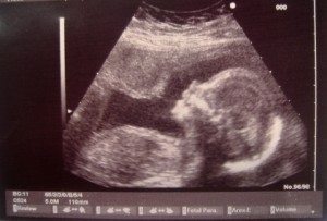LIFE-ultrasound-smiling-XS