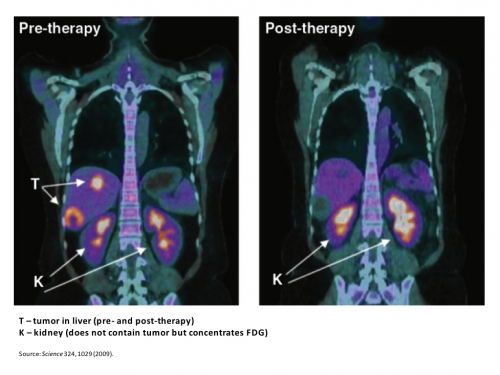 Cancer Blog Images