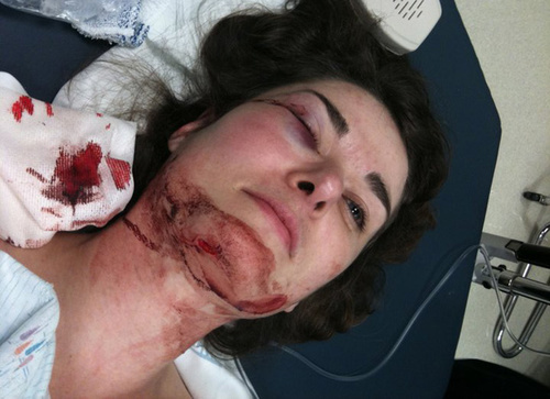 Photo by Anna Milioutina