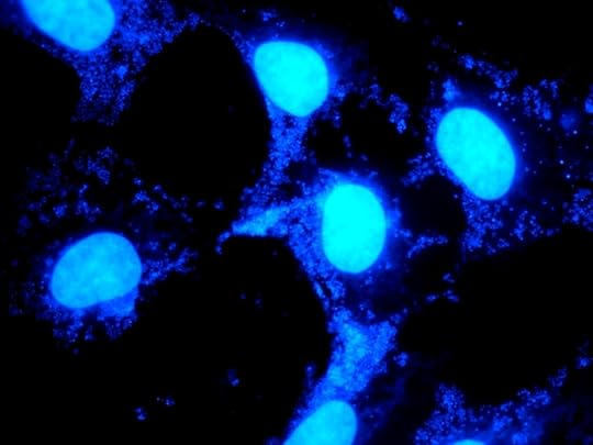 mycoplasma HMC soul stories