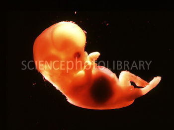 P6800399 Side view of a 12 week old foetus SPL