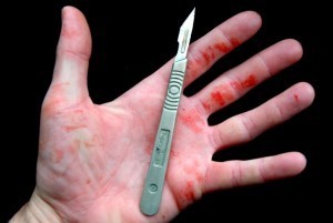 scalpel-blood-300x201