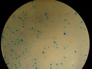 Analysis of faecal spots left by fruit flies allows life-long measurement of medium ingestion