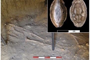 ancient egyptian skeleton with signs of earliest malignant cancer.