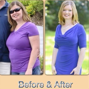 Melissa before and after