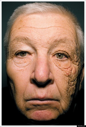 O BILL MCELLIGOTT SUN DAMAGE 570