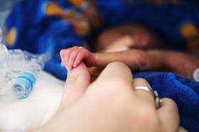Prematurity is a risk in a multiple pregnancy.