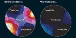 meditation-mind-brain-waves