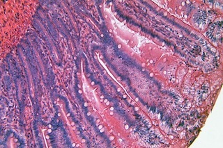 smallintestine