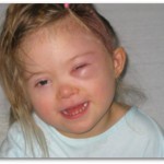 My daughter’s stroke & diagnosis of Moyamoya 