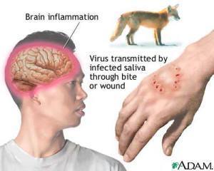 Rabies Symptoms, Diagnostic and Prevention