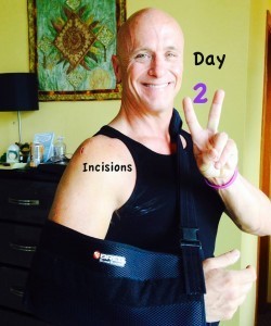 day 2 x 10