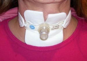 tracheostomy
