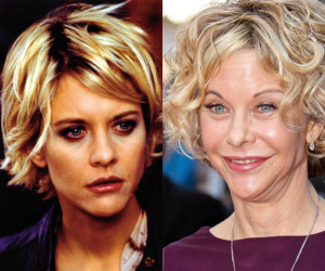 Meg Ryan, before and after she took the Joker's Insane Serum.