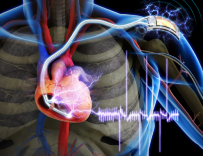 piezoelectric-pacemaker