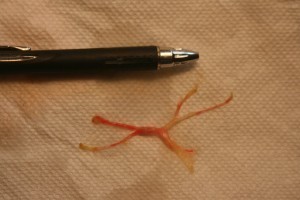 Lung Plug 04-21-2014