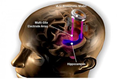 brain-implant-hippocampus-usc-640x424