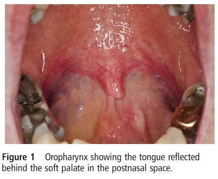 diagnosis-via-tongue