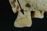 Tooth From Skeleton in Central Sudan