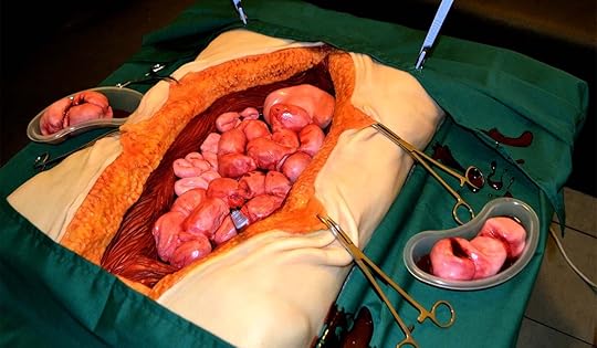 surgery cake1