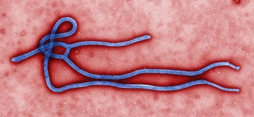 640px-Ebola_virus_virion.jpg