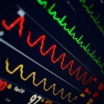 medical-monitor-375x250