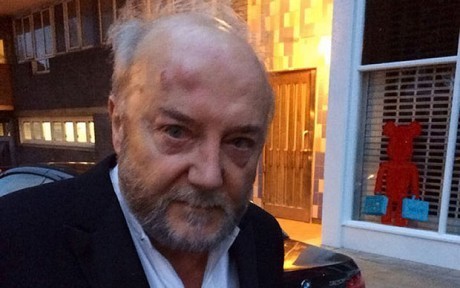 George Galloway after the attack