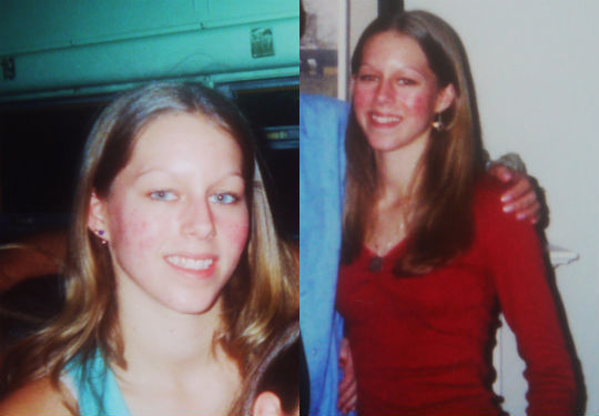 rachelbefore