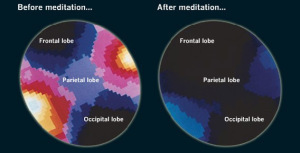 Frontal lobe meditation before and after