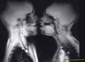 Life Looks Different Through An Mri Machine