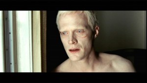 albino