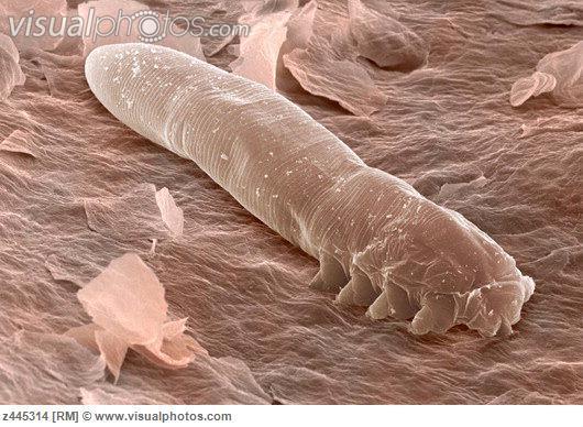 demodex