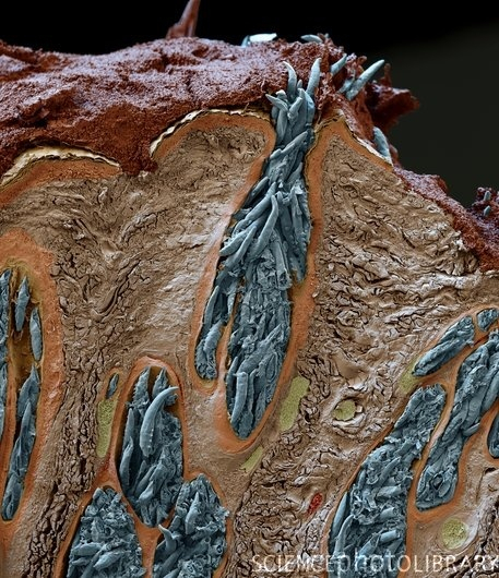 demodex2