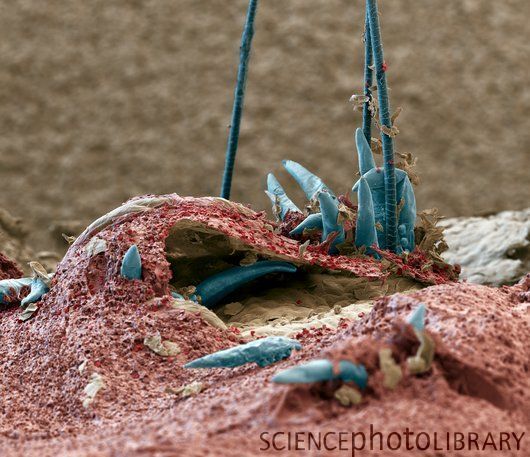 demodex4