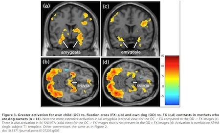 brain-images