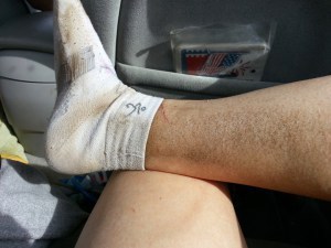 Some of My Cuts (and an Amazing Amount of Dirt)