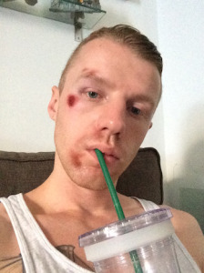 Bloody Face