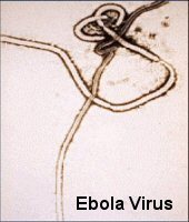 ebola virus
